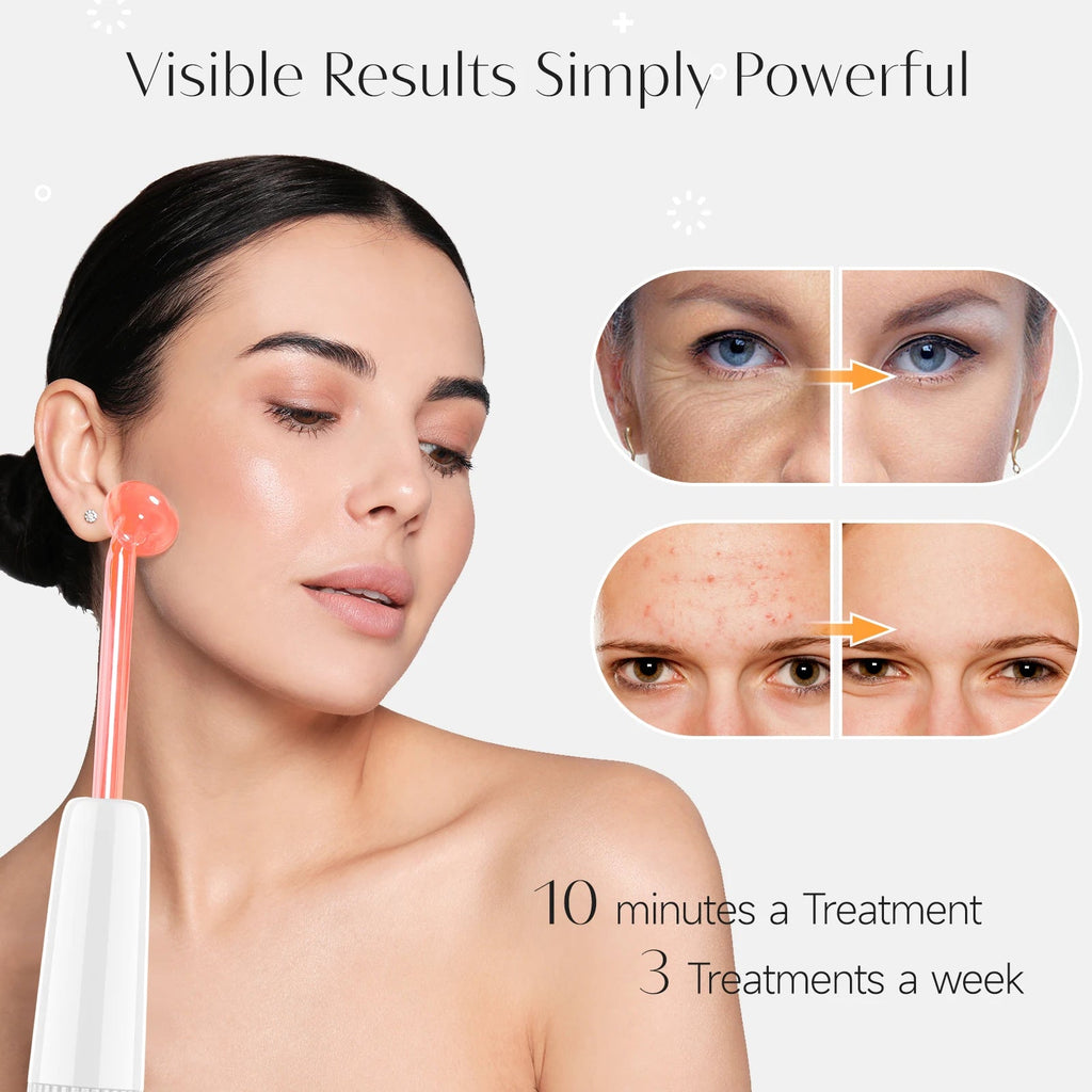 Glowvera™ High Frequency Wand