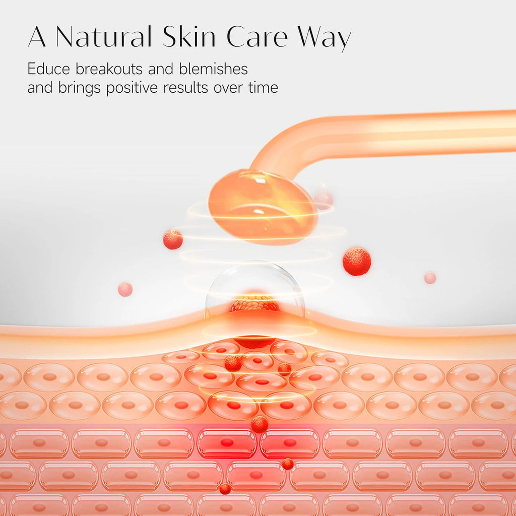 Glowvera™ High Frequency Wand