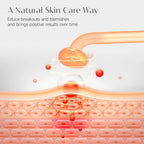 Glowvera™ High Frequency Wand
