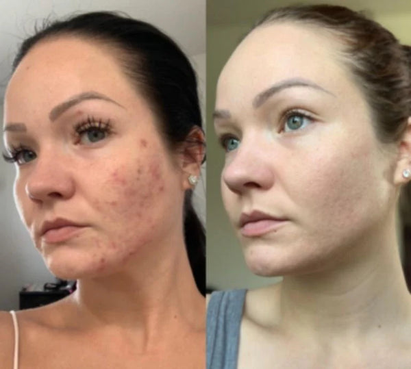 Grace P. review